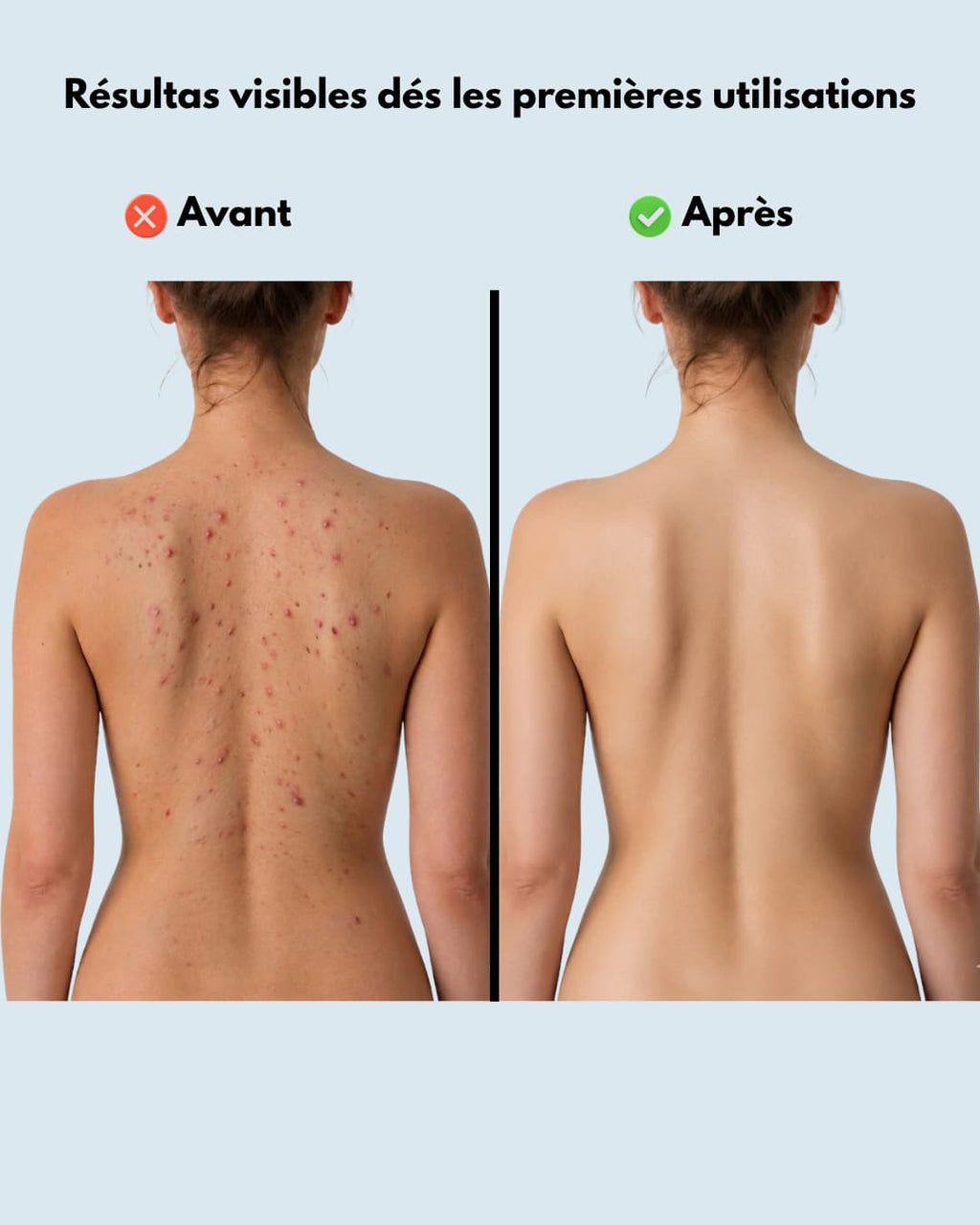 Serviette de douche exfoliante Auroven